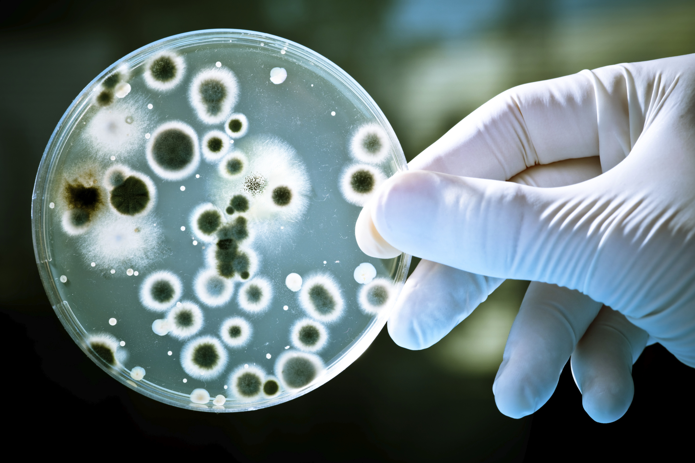 Dishwasher detergent kills bacteria