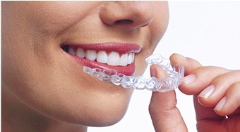 Straighten your Teeth in as little as Six Months with Clear Aligners