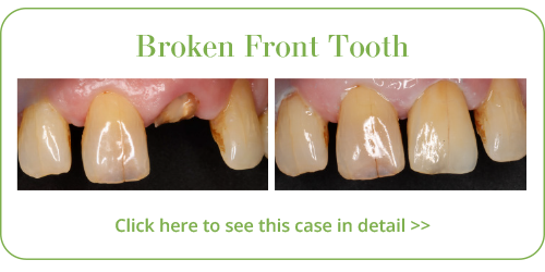 Cosmetic Dentistry Skegness