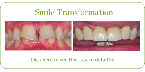 Cosmetic Dentistry Skegness